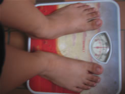 La obesidad infantil  no es un problema de estética