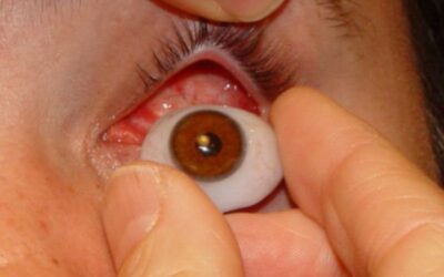Ciencia que entra por los ojos: innovación UNAB que ayuda a fabricación de prótesis oculares